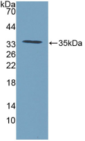 Active Connective Tissue Growth Factor (CTGF)