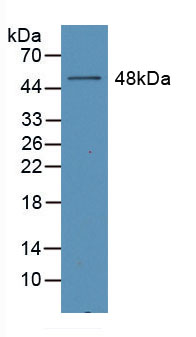 Active Erythropoietin (EPO)