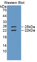 Active Interferon Gamma (IFNg)