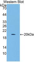 Active Interleukin 4 (IL4)
