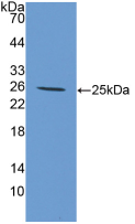 Active Interleukin 6 (IL6)