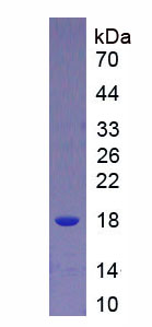 APA081Hu01.png