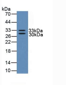 Active Nerve Growth Factor (NGF)