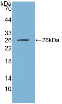 Active Tissue Inhibitors Of Metalloproteinase 3 (TIMP3)
