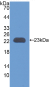 Active Tissue Inhibitors Of Metalloproteinase 3 (TIMP3)