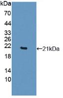 Active Tumor Necrosis Factor Alpha (TNFa)
