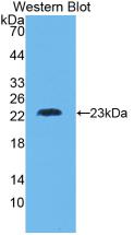 Active Tumor Necrosis Factor Beta (TNFb)