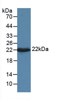 Active Vascular Endothelial Growth Factor A (VEGFA)