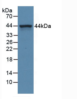 Active Complement Component 5a (C5a)
