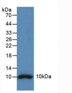Active Insulin (INS)