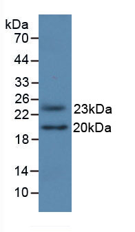 Active Fibroblast Growth Factor 2, Basic (FGF2)