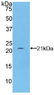 Active Fibrillin 1 (FBN1)
