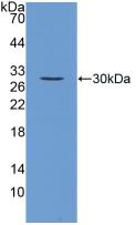 Active Fibroblast Growth Factor 23 (FGF23)