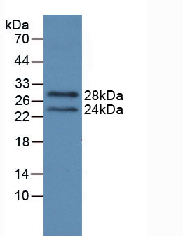 Active Prolactin (PRL)