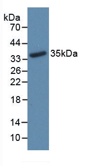Active Receptor Activator Of Nuclear Factor Kappa B Ligand (RANkL)