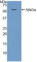 Active Parathyroid Hormone (PTH)