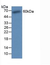 Active Osteopontin (OPN)