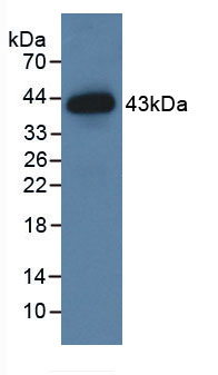 Active Extracellular Signal Regulated Kinase 2 (ERK2)