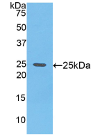Active Glypican 4 (GPC4)