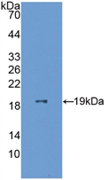 Active Endothelial Cell Specific Molecule 1 (ESM1)