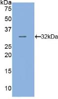 Active Tubulin Beta (TUBb)