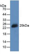 Active Cold Inducible RNA Binding Protein (CIRBP)