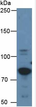 Active Angiotensin I Converting Enzyme 2 (ACE2)