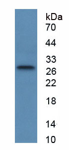 Active Tissue Factor Pathway Inhibitor 2 (TFPI2)