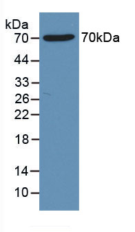 Active Histone Deacetylase 1 (HDAC1)