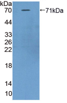 Active Asporin (ASPN)