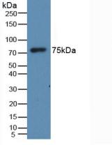 Active Histidine Rich Glycoprotein (HRG)