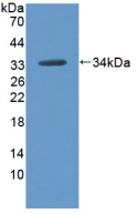 Active Glucosidase Alpha, Neutral AB (GaNAB)
