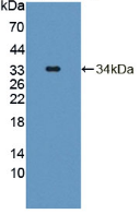 Active Tyrosine Aminotransferase (TAT)