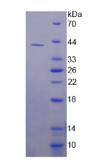 APJ271Hu01.png